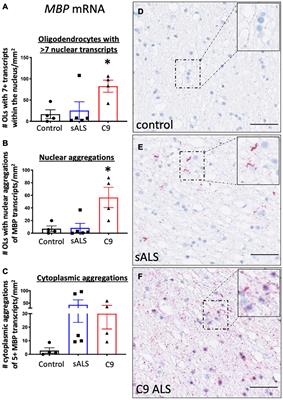 Dysregulation in Subcellular Localization of Myelin Basic Protein mRNA Does Not Result in Altered Myelination in Amyotrophic Lateral Sclerosis